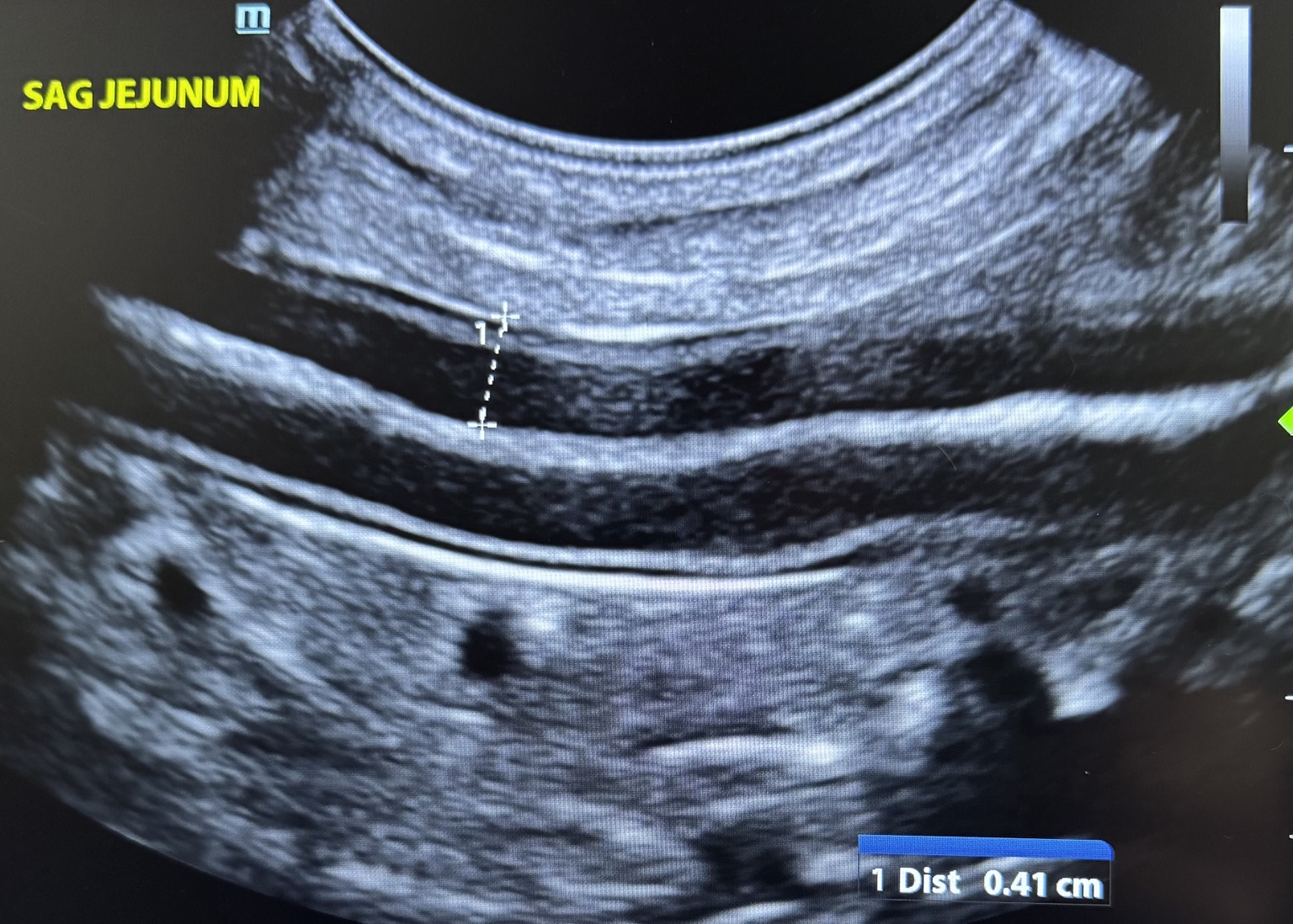 Sagittal veterinary ultrasound of the jejunum, intestinal wall measured at 0.41 centimetres